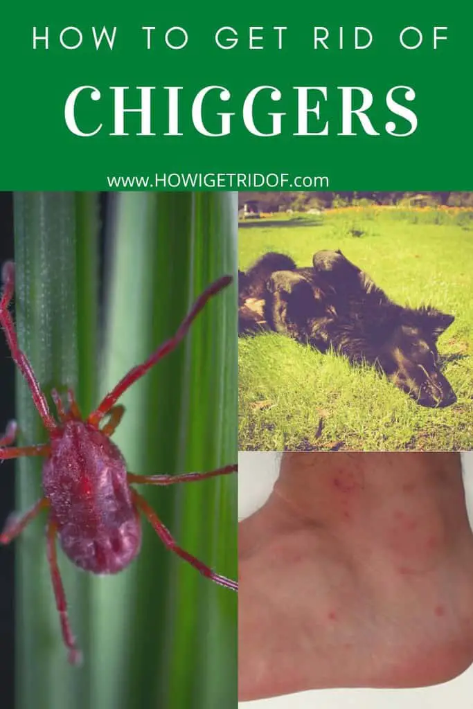 How To Get Rid of Chiggers